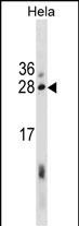 Rabbit Polyclonal Antibody to EBAG9
