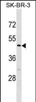 Rabbit Polyclonal Antibody to CASQ2