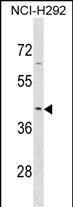 Rabbit Polyclonal Antibody to SERPINB9