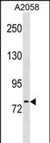 Rabbit Polyclonal Antibody to NLN