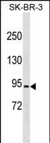 Rabbit Polyclonal Antibody to RFWD2