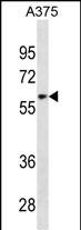 Rabbit Polyclonal Antibody to ZNF394