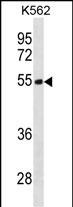 Rabbit Polyclonal Antibody to TES (N-term)
