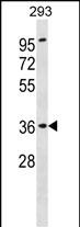 Rabbit Polyclonal Antibody to ATP6AP2