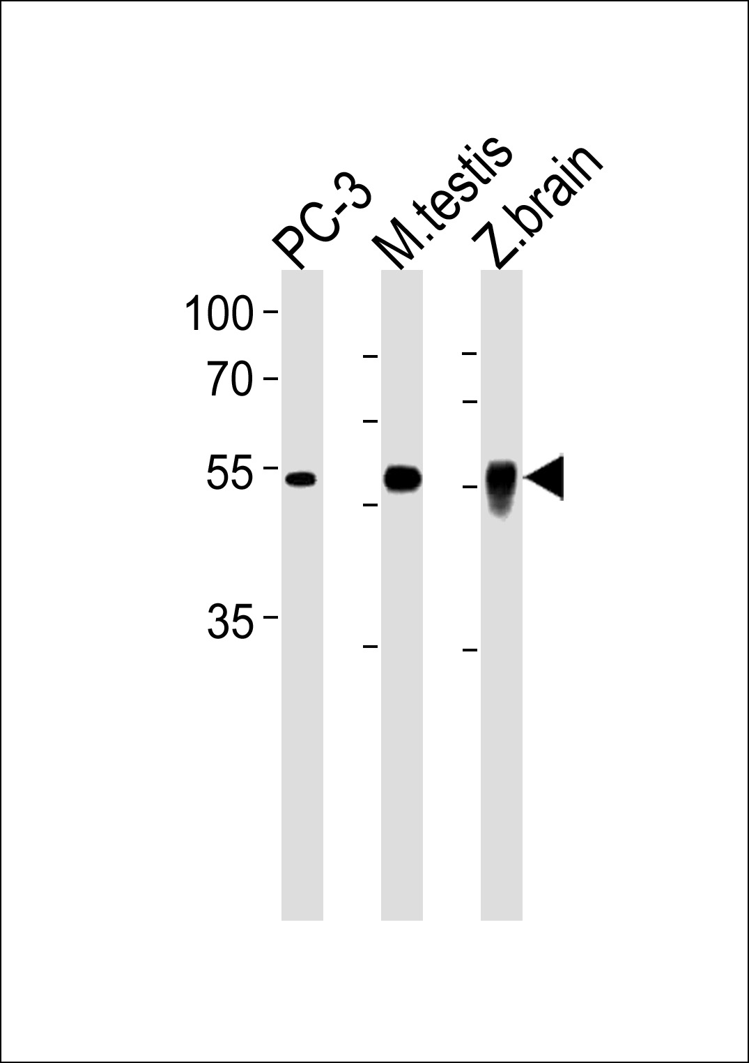 Rabbit Polyclonal Antibody to DMRTA2