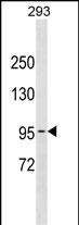 Rabbit Polyclonal Antibody to POLK