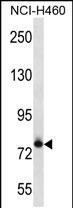 Rabbit Polyclonal Antibody to FCRL3