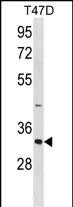 Rabbit Polyclonal Antibody to HAVCR2