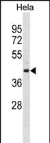Rabbit Polyclonal Antibody to ADPRH