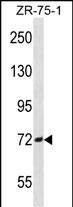 Rabbit Polyclonal Antibody to SCNN1B