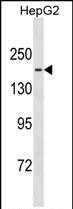 Rabbit Polyclonal Antibody to TTBK1