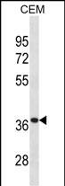Rabbit Polyclonal Antibody to TTPA