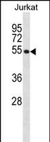 Rabbit Polyclonal Antibody to CREB3 (N-term)