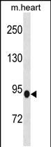 Rabbit Polyclonal Antibody to PDE8B