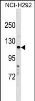 Rabbit Polyclonal Antibody to HPS5 (N-term)