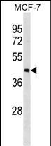 Rabbit Polyclonal Antibody to ILF2 (N-term)