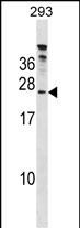 Rabbit Polyclonal Antibody to HTATSF1