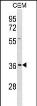 Rabbit Polyclonal Antibody to EFNB1
