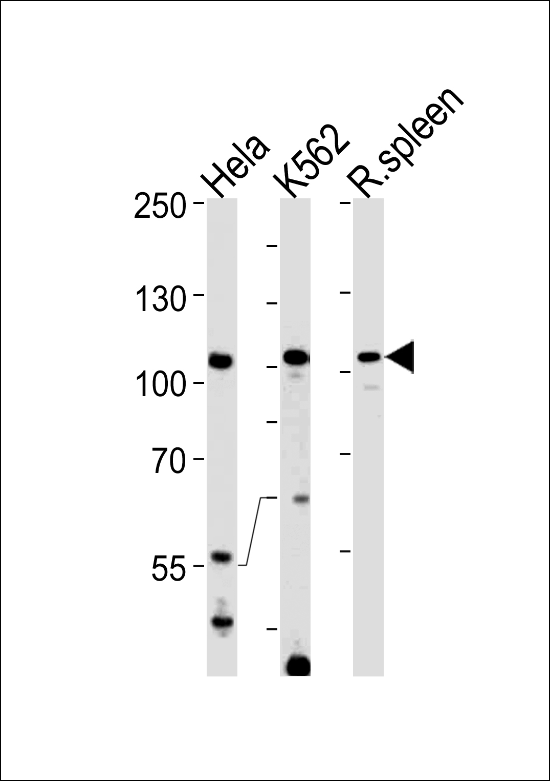 Rabbit Polyclonal Antibody to TFIP11 (N-term)