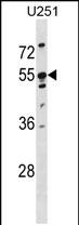 Rabbit Polyclonal Antibody to KRT86