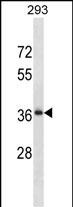 Rabbit Polyclonal Antibody to RALYL (N-term)