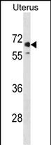 Rabbit Polyclonal Antibody to MMEL1 (N-term)