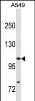 Rabbit Polyclonal Antibody to GEMIN4 (N-term)
