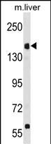 Rabbit Polyclonal Antibody to UBR1 (N-term)