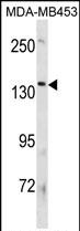 Rabbit Polyclonal Antibody to ATP8B3 (N-term)