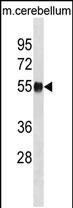 Rabbit Polyclonal Antibody to Mouse Ppm1h