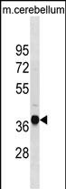 Rabbit Polyclonal Antibody to Mouse Ublcp1