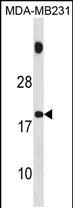 Rabbit Polyclonal Antibody to SPNXB