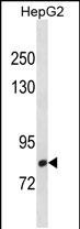 Rabbit Polyclonal Antibody to CMIP