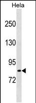 Rabbit Polyclonal Antibody to LRCH1