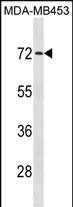 Rabbit Polyclonal Antibody to MEX3C