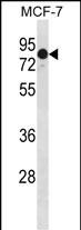 Rabbit Polyclonal Antibody to GATAD2A (N-term)