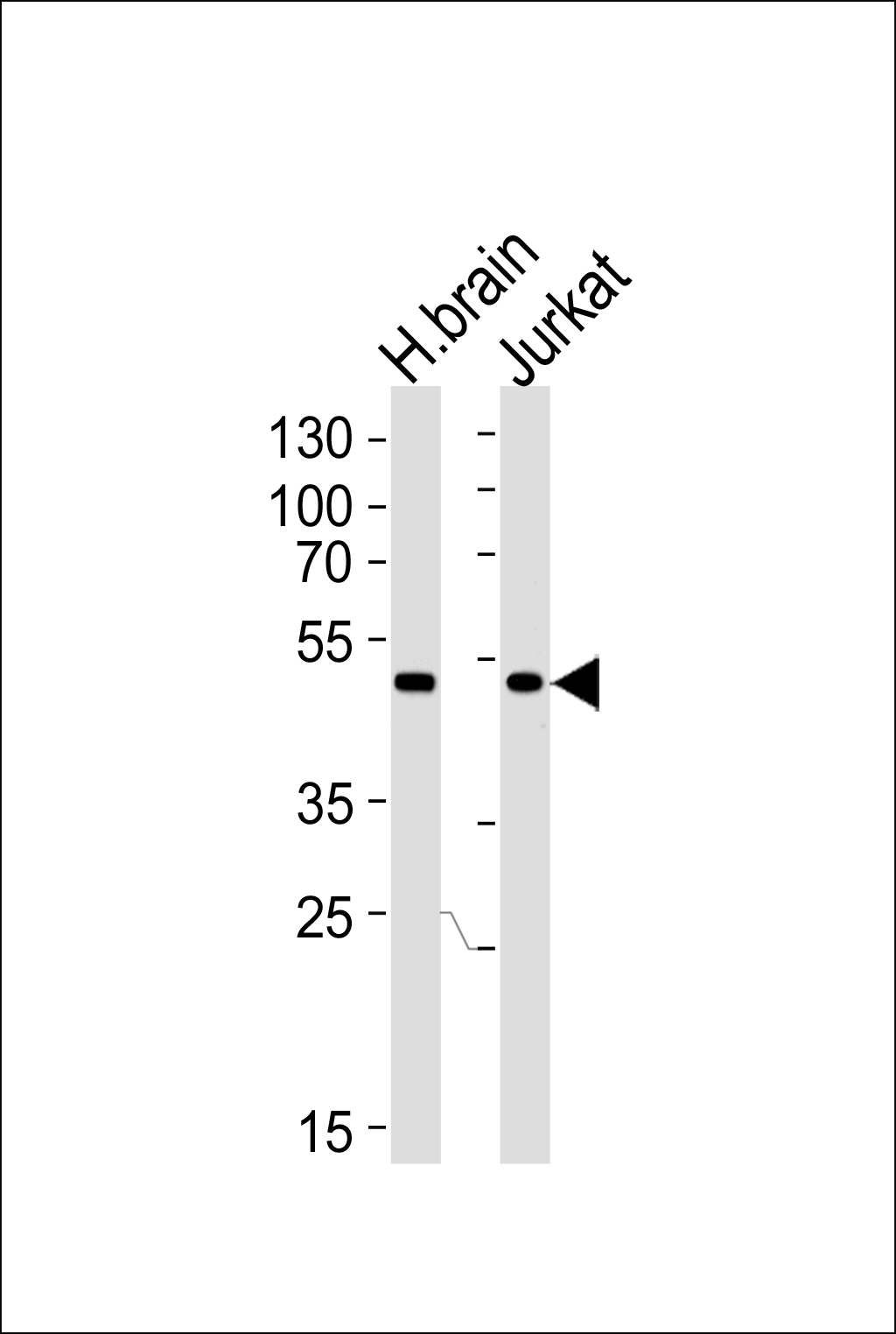 Rabbit Polyclonal Antibody to CHN1 (N-term)