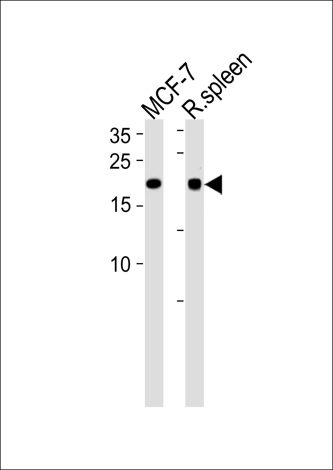Rabbit Polyclonal Antibody to CNBP