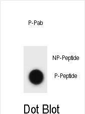 Rabbit Polyclonal Antibody to Phospho-mouse CCNB3(T257)