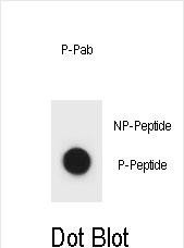 Rabbit Polyclonal Antibody to Phospho-IKKB(S177)