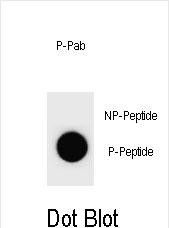 Rabbit Polyclonal Antibody to Phospho-mouse CCNB3(S1063)