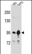 Rabbit Polyclonal Antibody to CTNNB1
