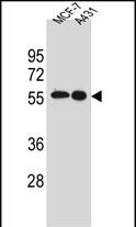 Rabbit Polyclonal Antibody to SRC (N-term)