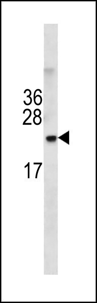 Rabbit Polyclonal Antibody to TMEM199 (N-term)
