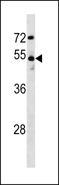 Rabbit Polyclonal Antibody to DCLK1