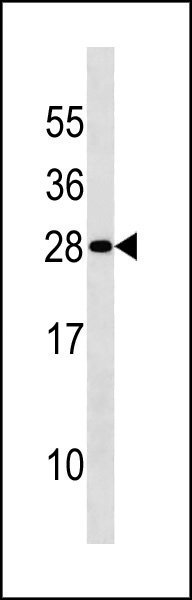 Rabbit Polyclonal Antibody to DENR