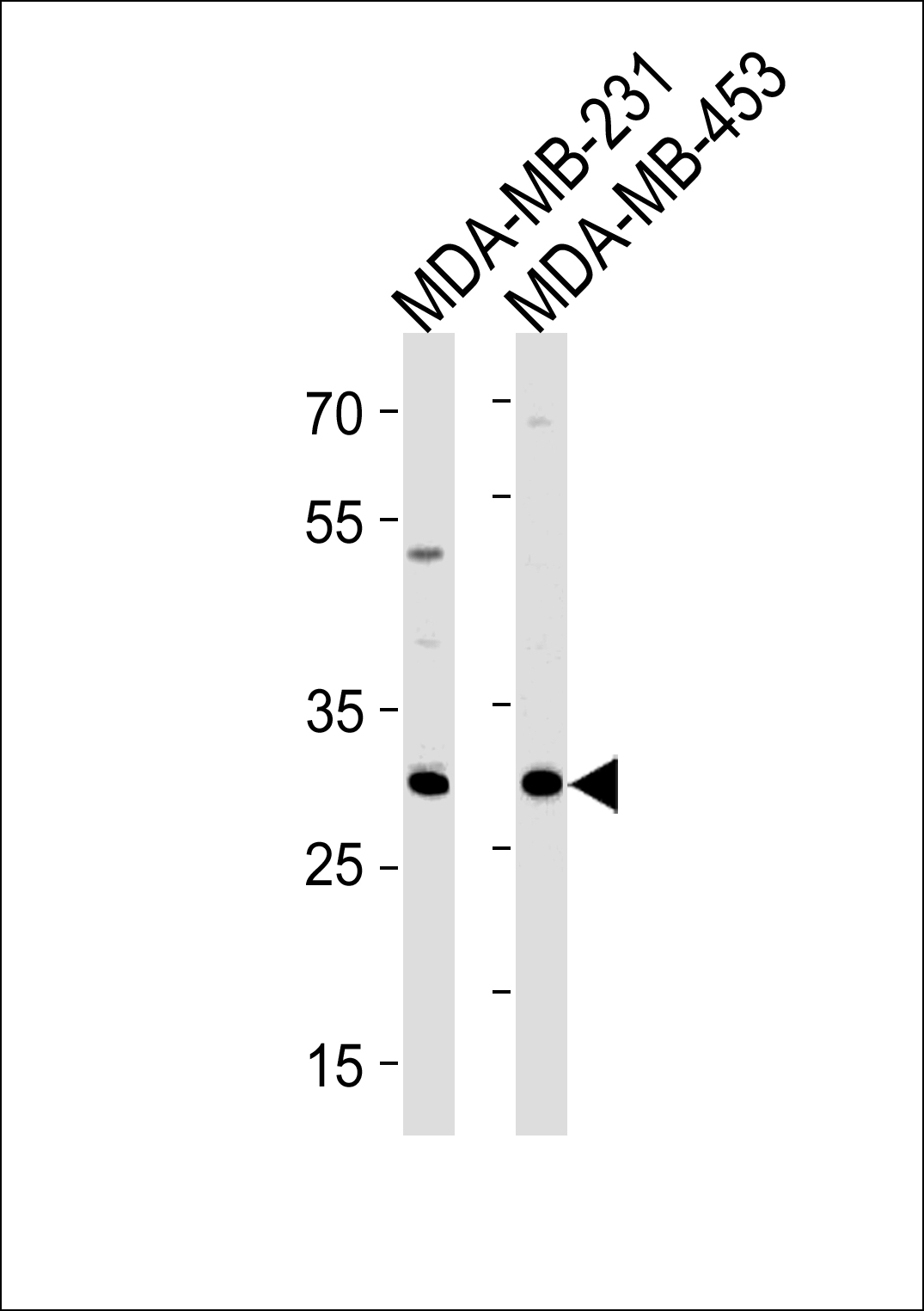 Rabbit Polyclonal Antibody to ASB11 (N-term)