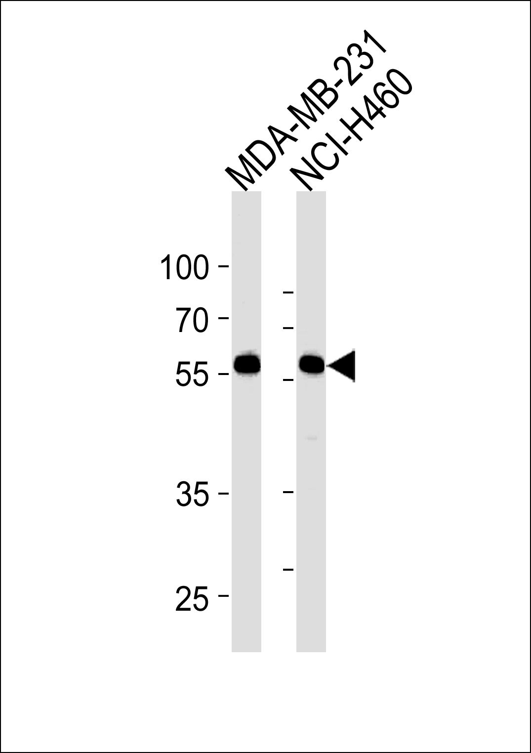 Rabbit Polyclonal Antibody to RFTN1