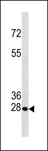 Rabbit Polyclonal Antibody to Bcl-2 (Center Ser70)
