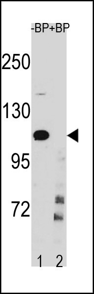 Rabbit Polyclonal Antibody to IKKB (Center Y609)